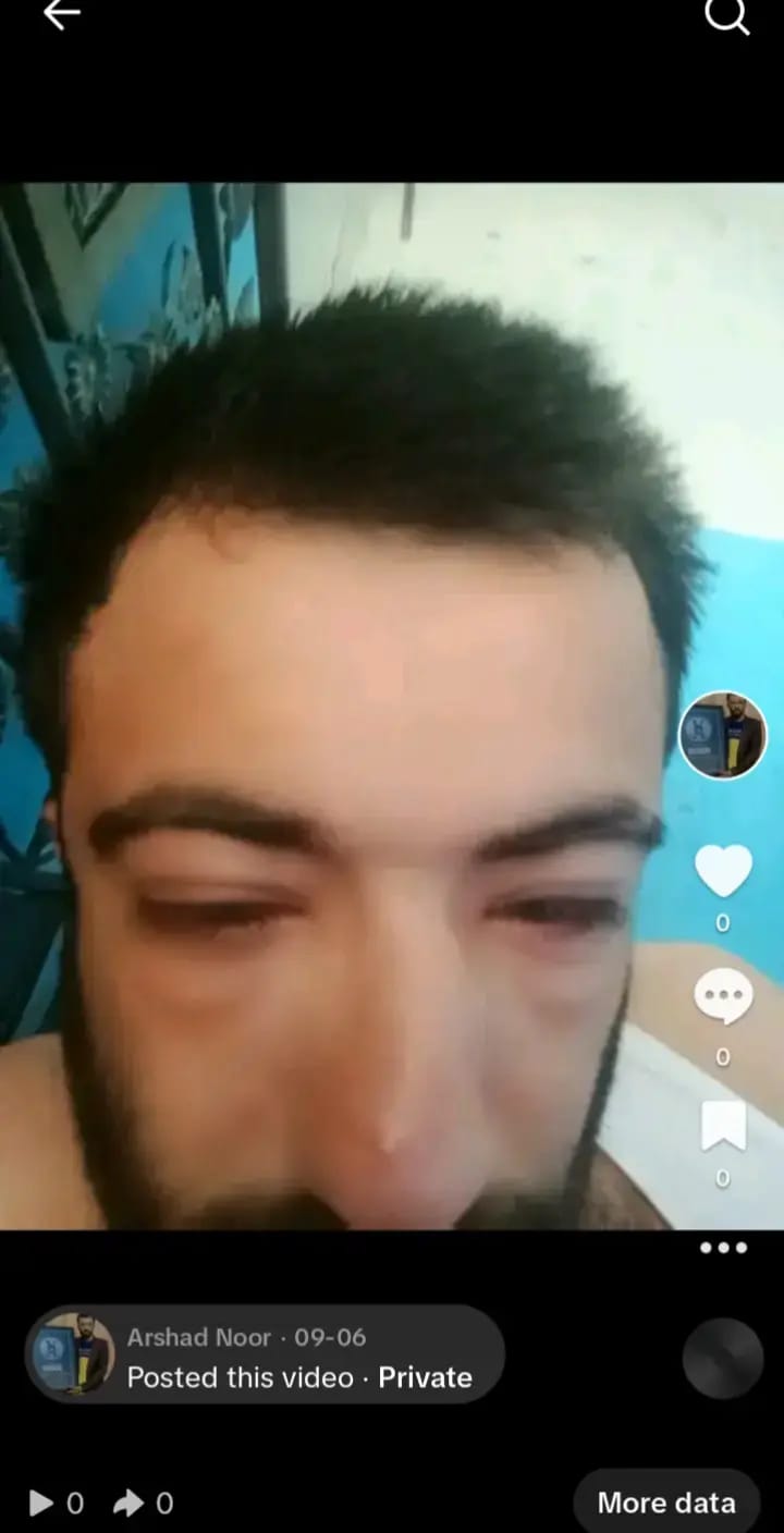 TikTok private video — eyes closed