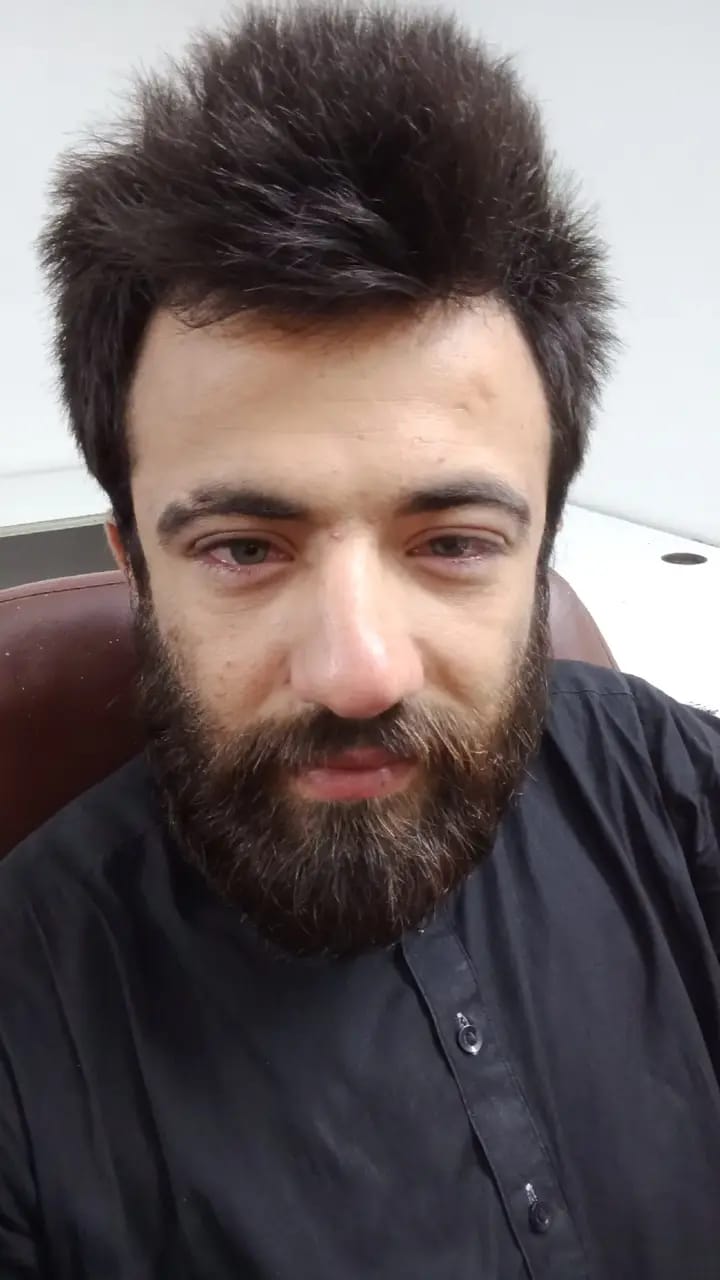 Broken eyes black kameez